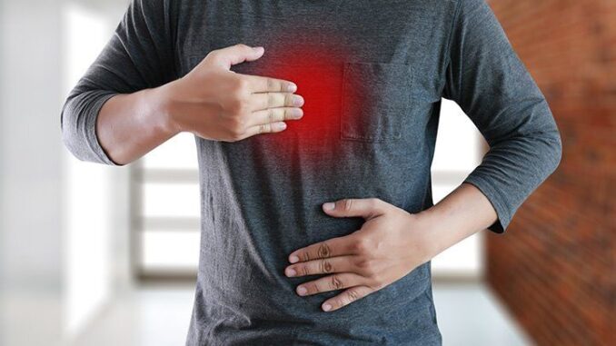 acid reflux causes, symptoms treatments remedies