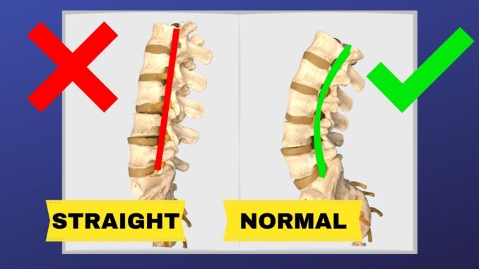 Understanding Lumbar Anatomy in Relation to Lower Back Pain - Fitness ...